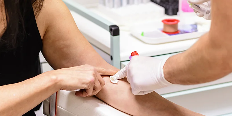 What do Common Blood Investigative Tests Mean and How to Get Them?