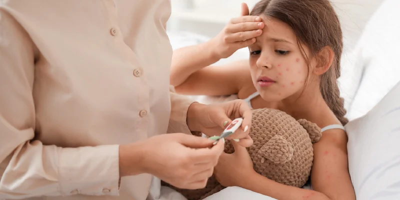 Varicella (Chickenpox) Vaccine: Benefits and Who Should Take?